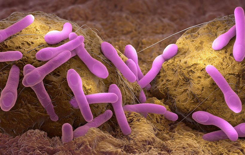 бактерия ботулизма